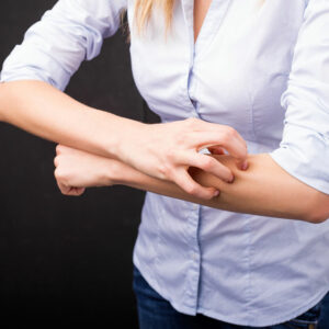 10 common early signs of prurigo nodularis